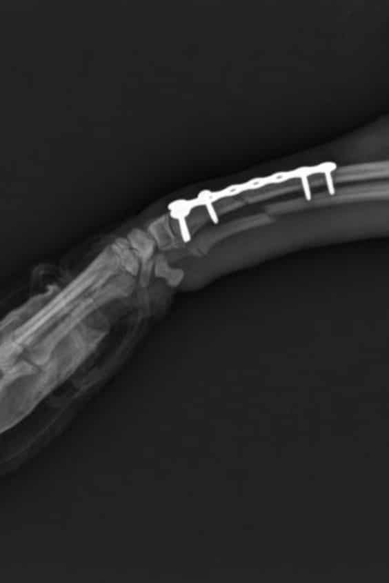 chirurgie-ric-rac_0002_fracture radius